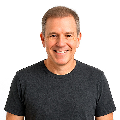 3 meses - injerto capilar