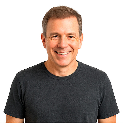 6 meses - injerto capilar