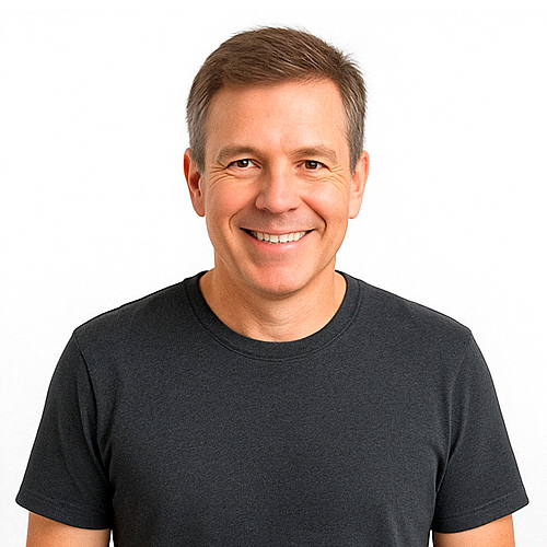 9 meses - injerto capilar